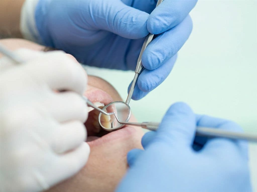 Revisión de odontología preventiva en la clínica dental Encisa de A Coruña