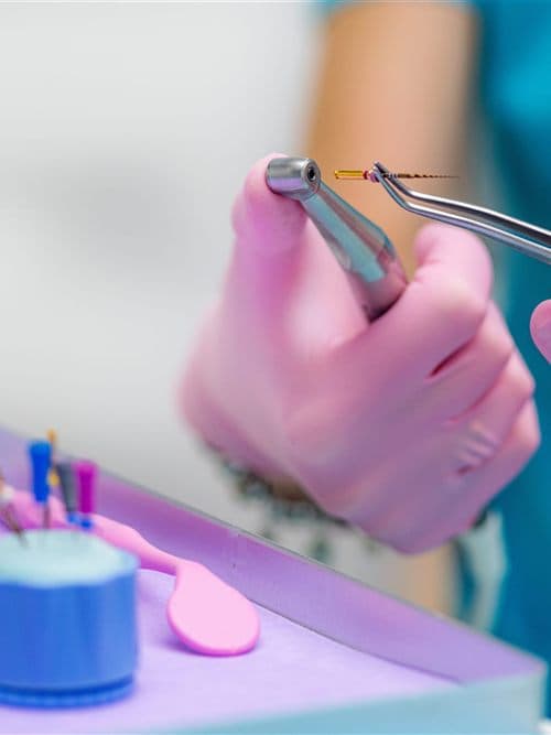 Endodoncia en A Coruña - Encisa