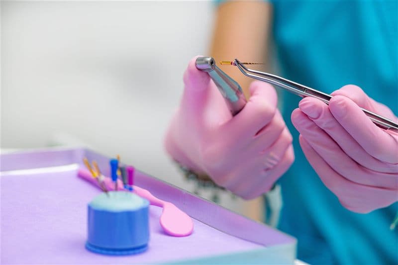 Endodoncia en A Coruña