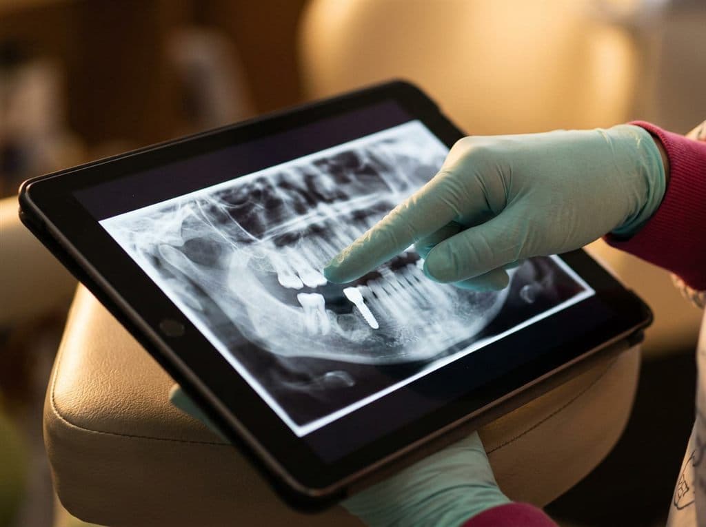 Tratamiento de endodoncia en la clínica dental Encisa de A Coruña