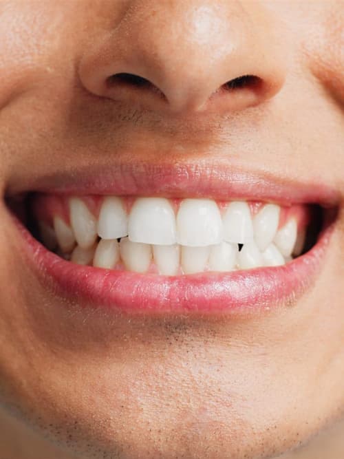 Odontología conservadora en A Coruña - Encisa