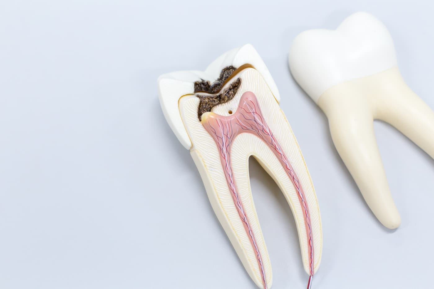 Endodoncia - Encisa